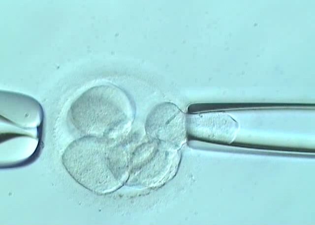 Biopsia Embrionario - Reproduccion Bilbao