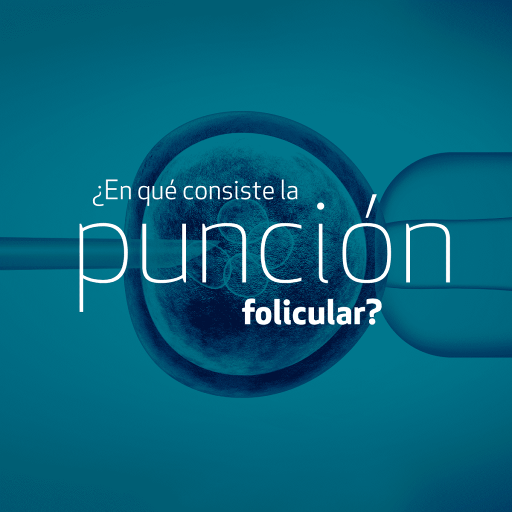 ¿En qué consiste la punción folicular