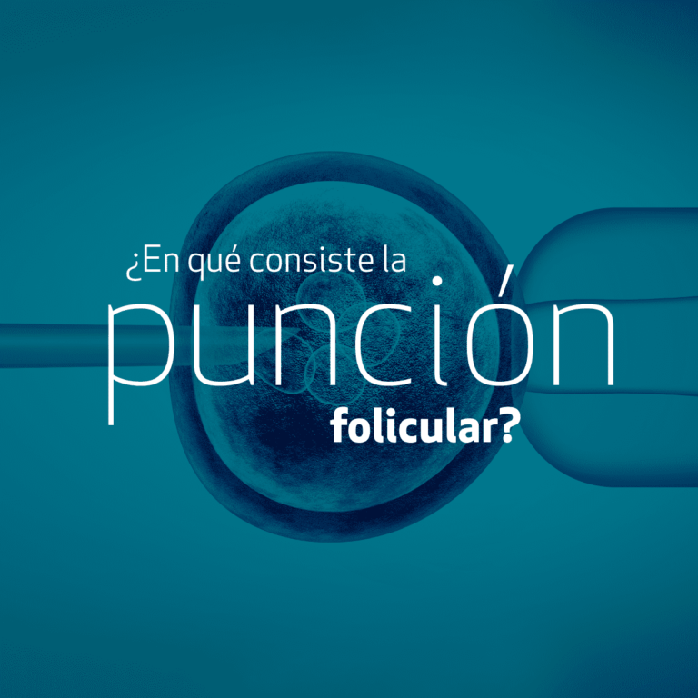 ¿En qué consiste la punción folicular