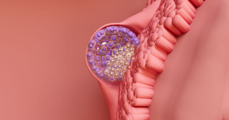 Implantación de embriones