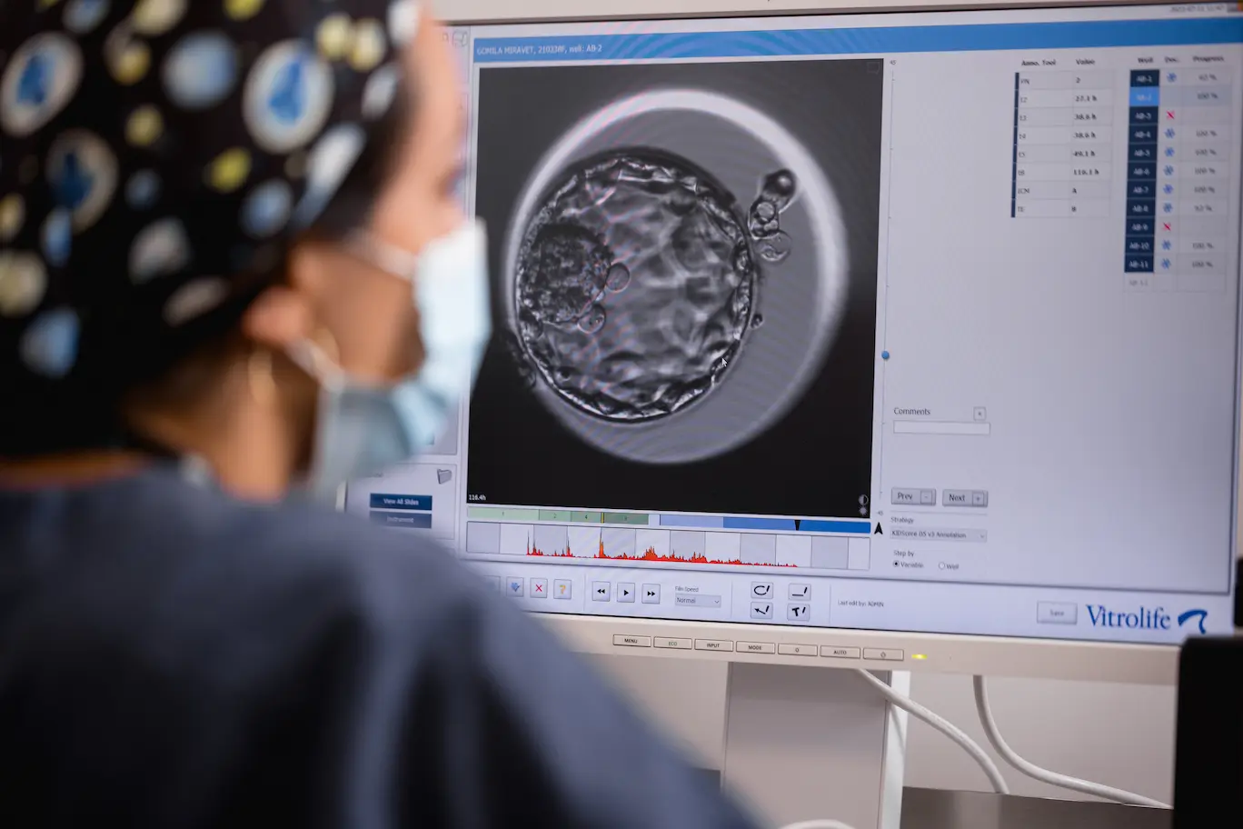 Diagnóstico Genético Preimplantacional en Reproducción Bilbao