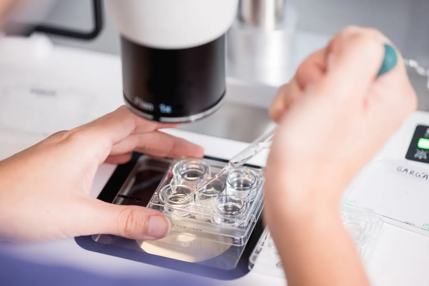 Tratamiento de fecundación in vitro en Reproducción Bilbao